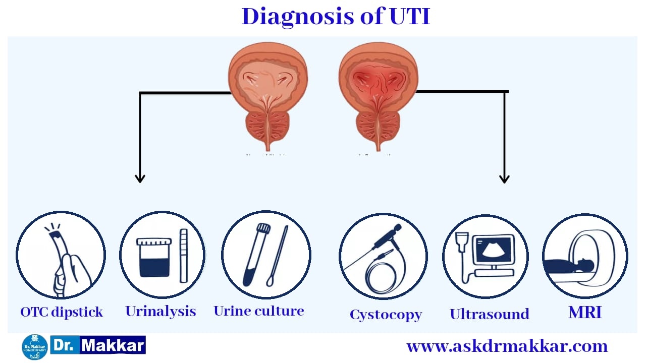 Diagnosis of uti urinary tract infections Uti Cystitis India
