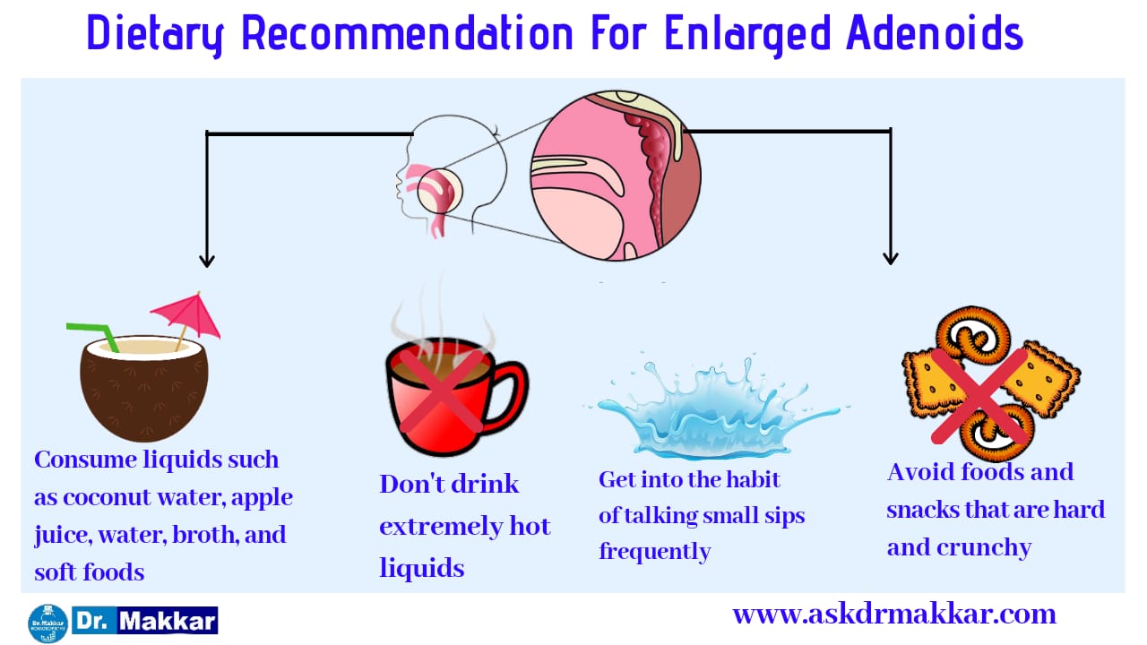 Diet to prevent adenoid facies