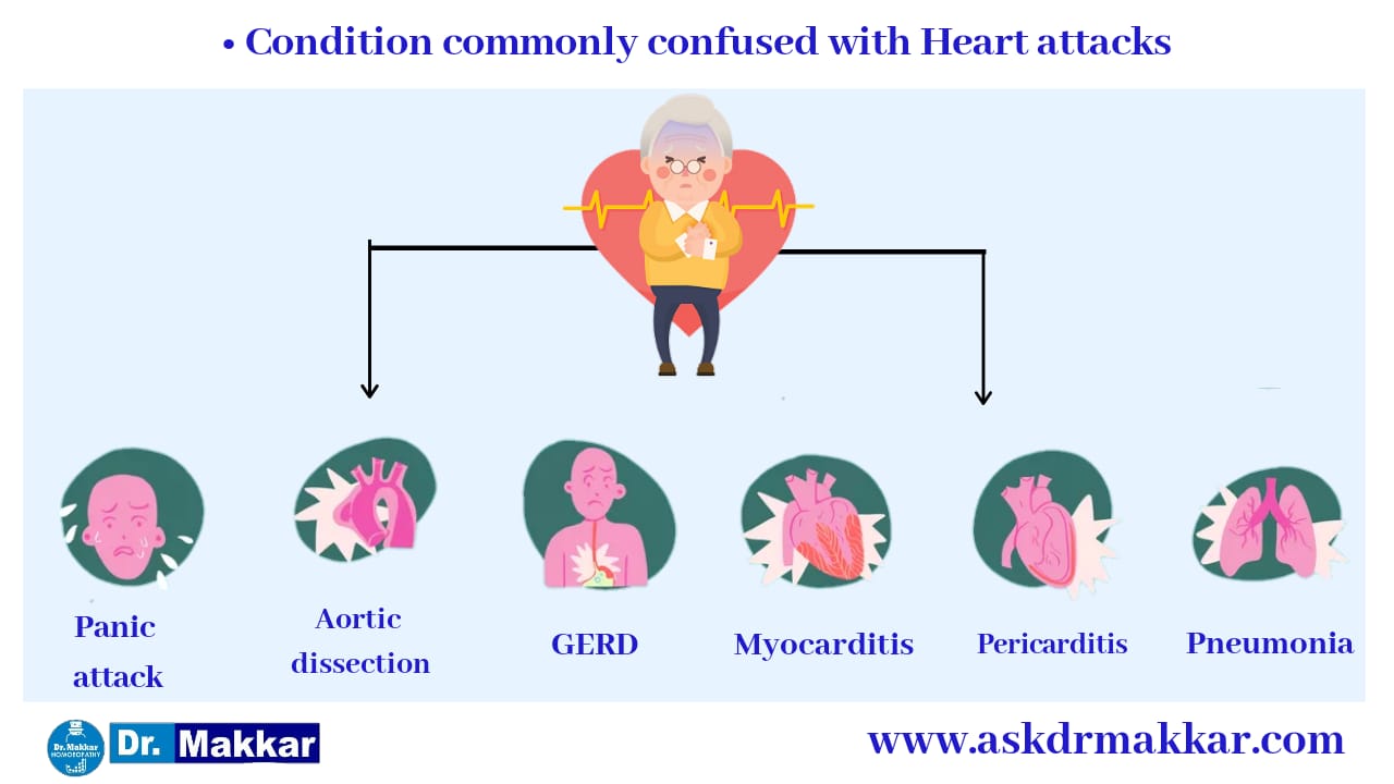 Differential diagnoses for Heart Attack || हार्ट अटैक या  दिल की बीमारी विभेदक क्रमानुसार रोग निदान