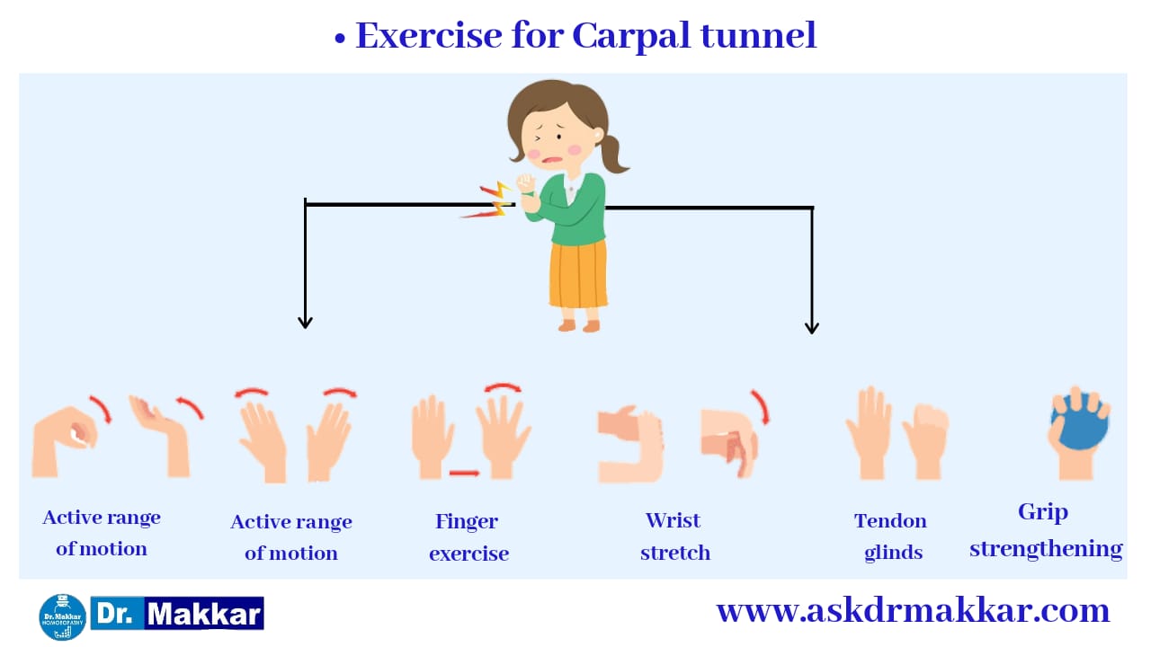 Exercises as Self care measures exercises Carpal tunnel syndrome || कार्पल टनल सिंड्रोम में सूजन 