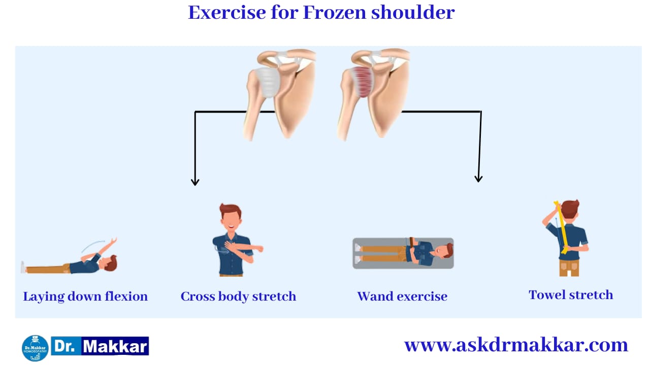 Exercises as Self care measures exercises Frozen Shoulder stiffness of shoulder || कंधे की अकड़न फ्रोज़न शोल्डर में सूजन व्यायाम