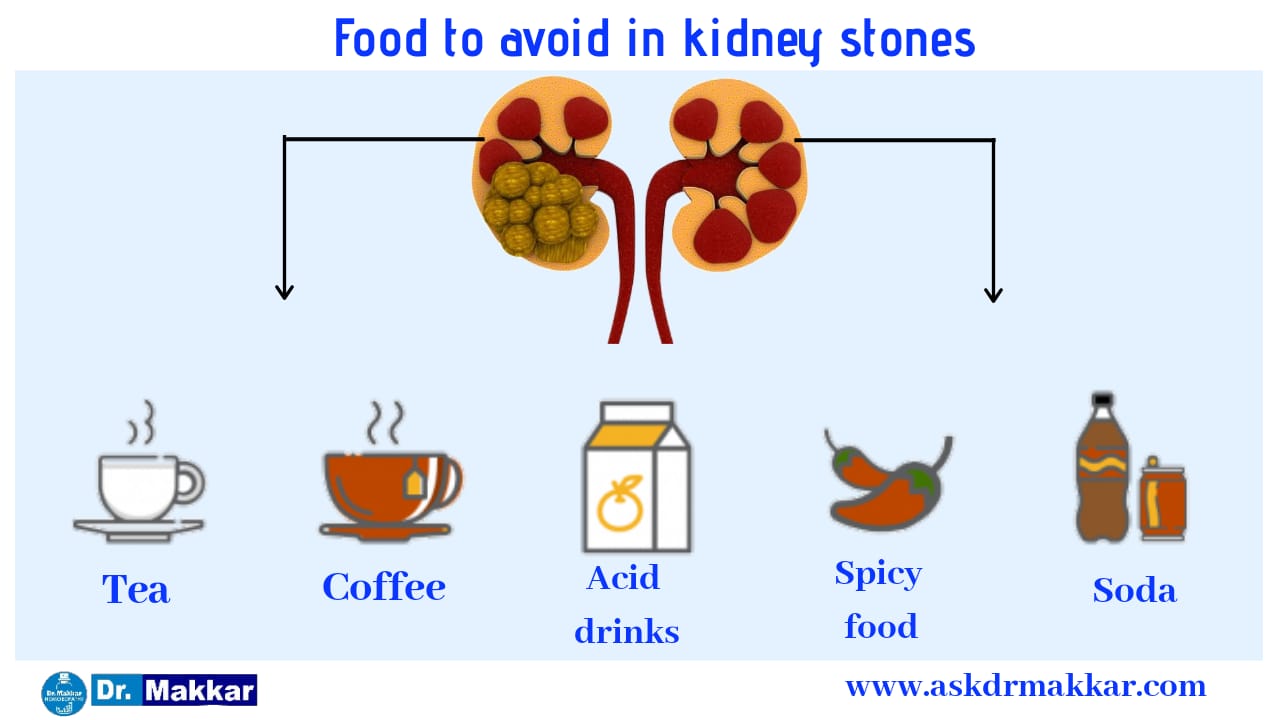 Food to avoid in Kidneystone patient