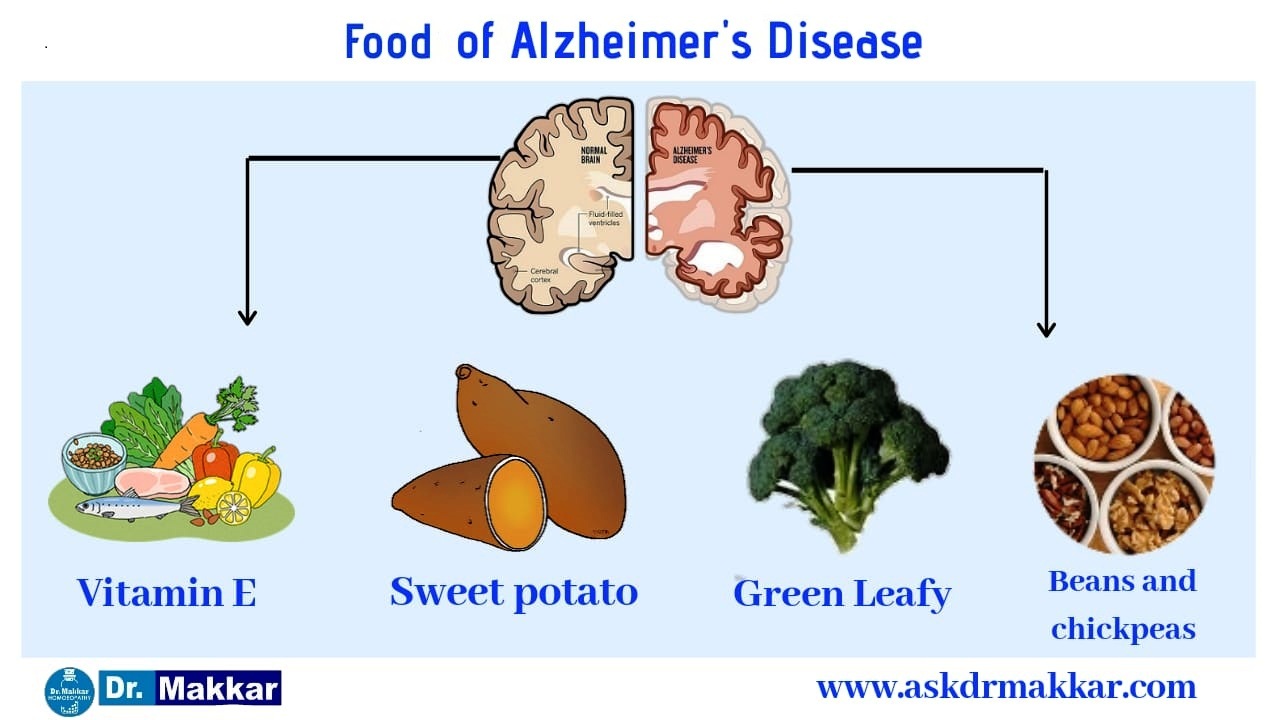 Foods for Alzheimer's Photo