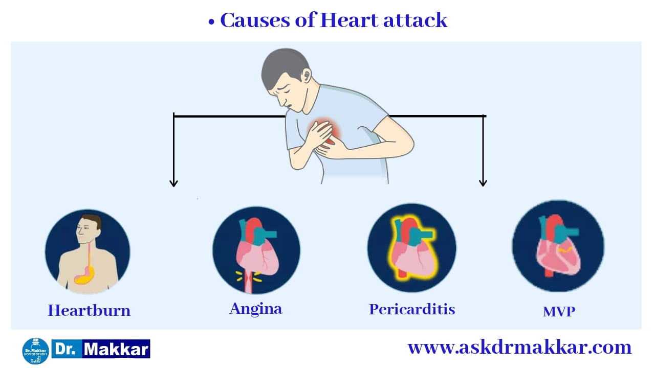 Heart Attack causes || हार्ट अटैक के कारण