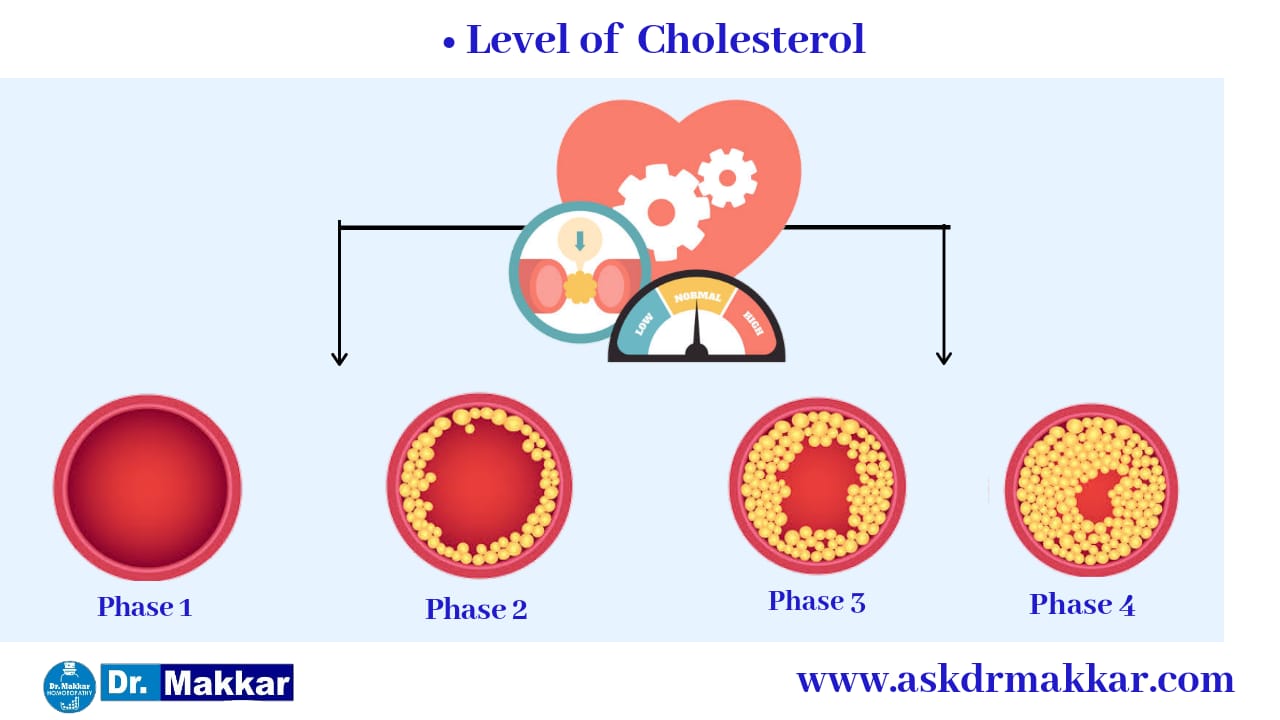 High Cholestrol diagnosis for finding hyper lipidaemia  हाइपर लिपिडिमिया का पता लगाने के लिए उच्च कोलेस्ट्रोल निदान