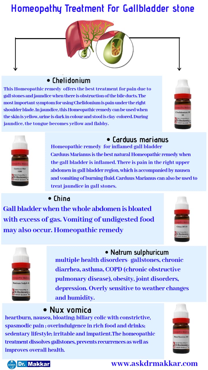 Homeopathic Medicine for Gallstone Cholelithiasis