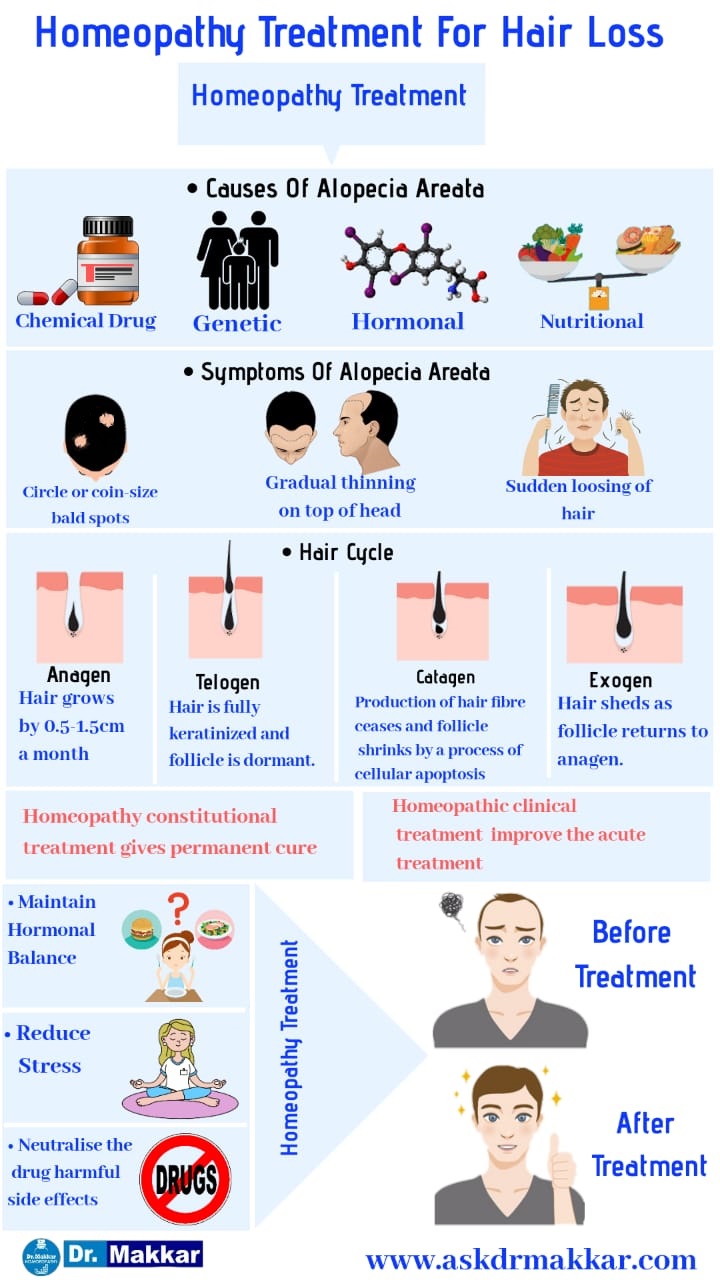 Homeopathic Treatment  for hair loss Alopecia aerata