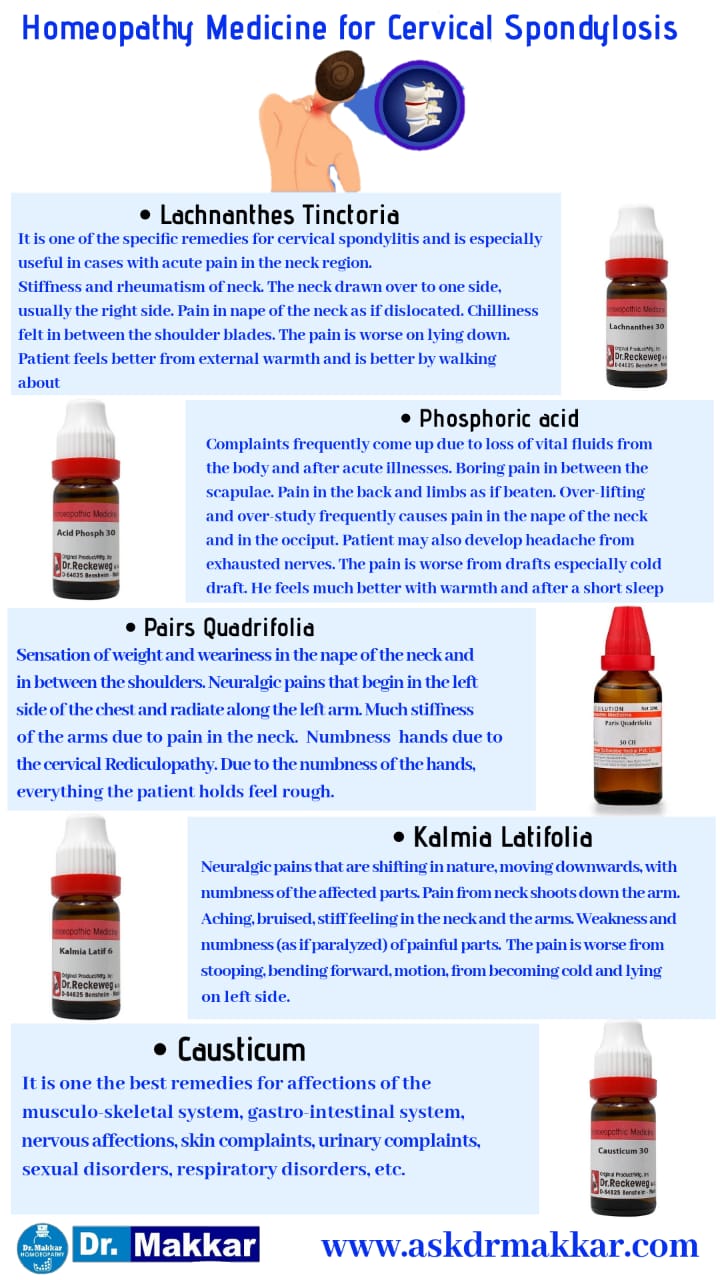 Best Homeopathic medicines for Cervical Spondylosis relieve  Neck Pain instanly top remedies || सर्वाइकल स्पोंडिलोसिस के लिए सर्वश्रेष्ठ होम्योपैथिक दवाएं गर्दन के दर्द से राहत दिलाती हैं
