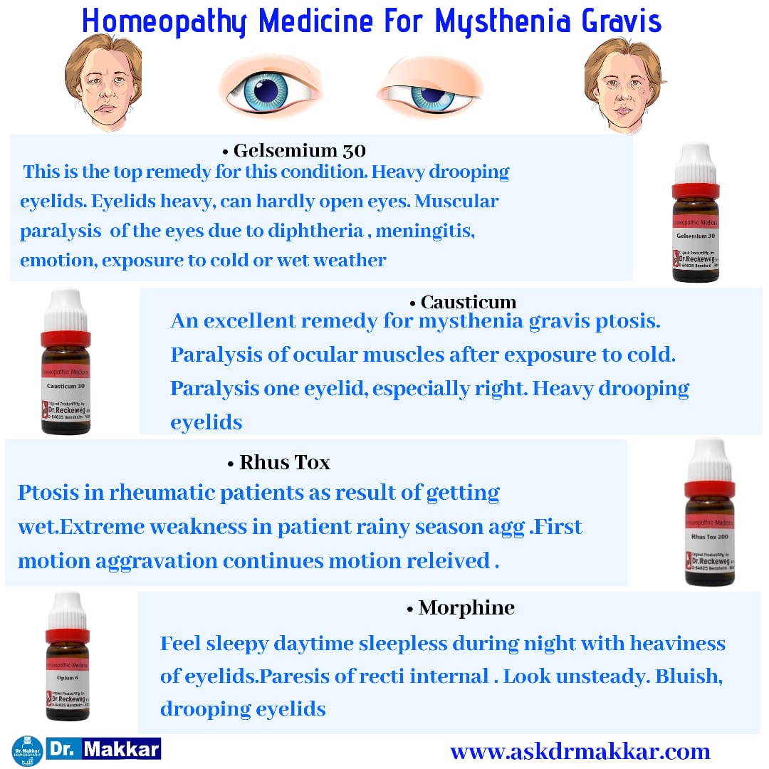 Homeopathic medicine for Mysthenia Gravis