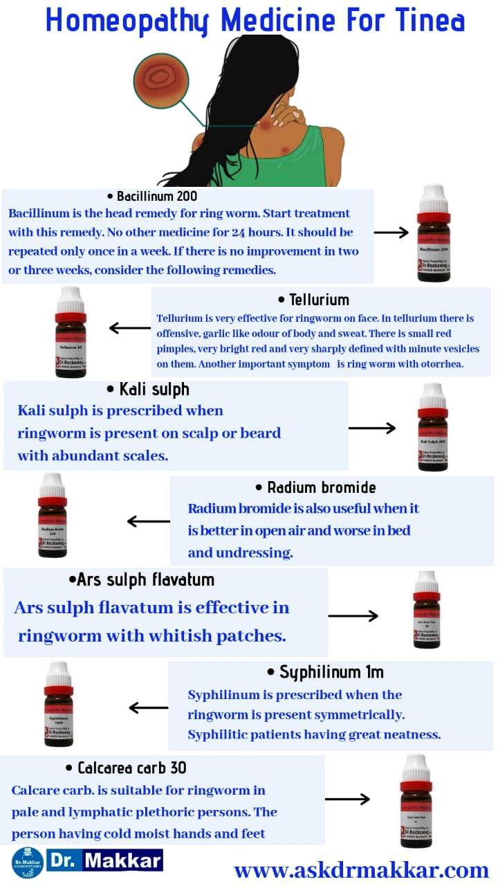 Homeopathic medicine for tinea