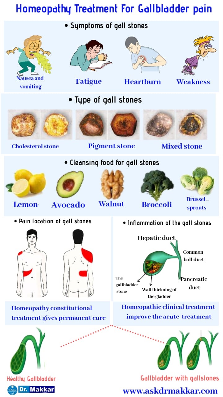 Homeopathic treatment for Gallstone Cholelithiasis