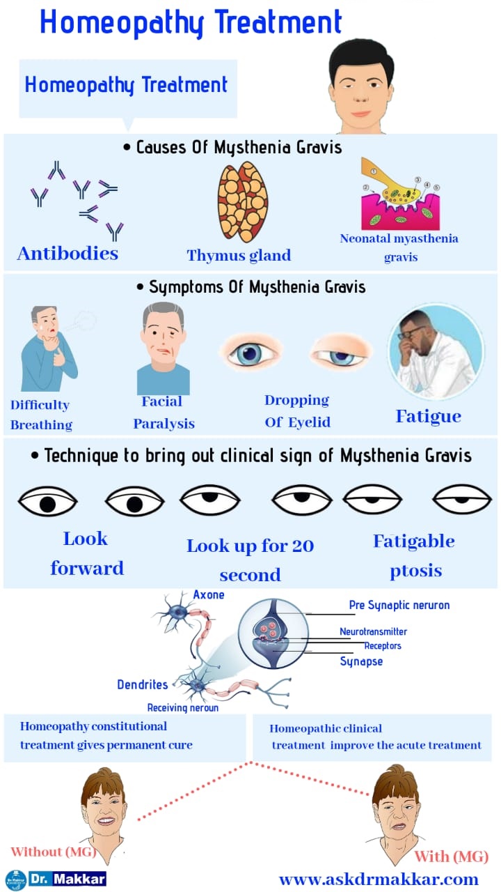 Homeopathic treatment for Mysthenia Gravis 