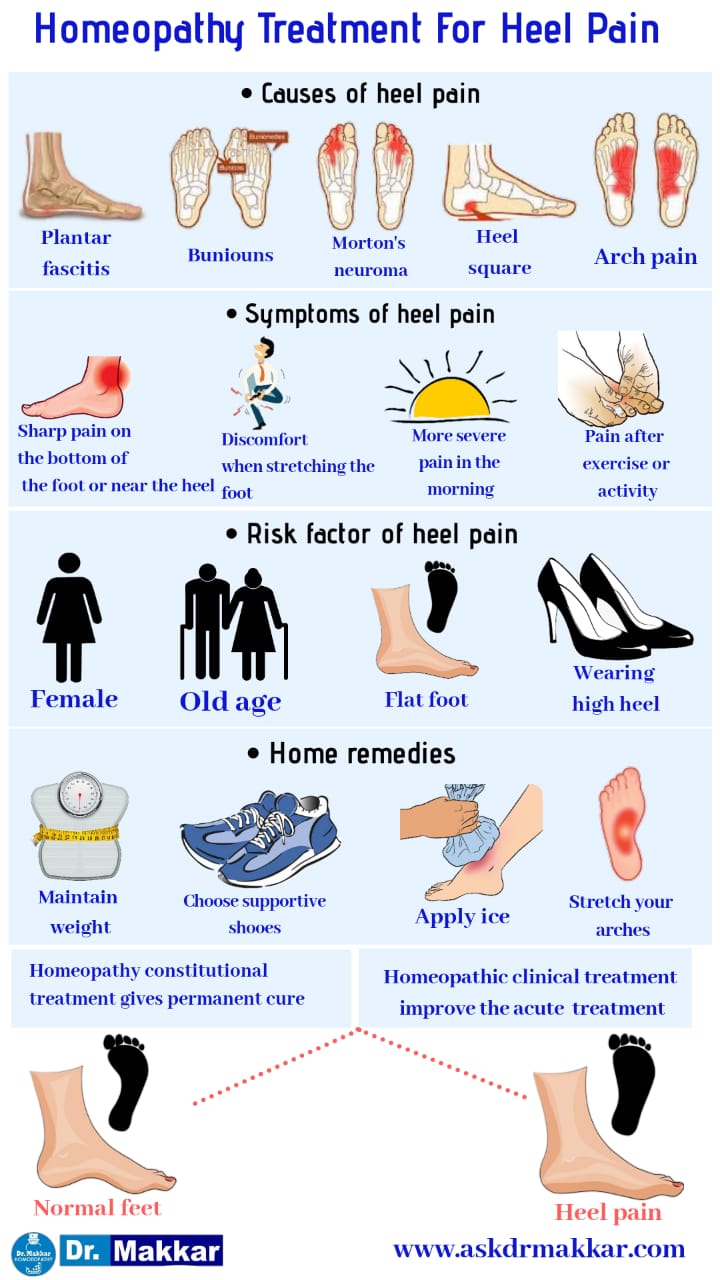 Homeopathic treatment for heel pain Calcaneal Spur