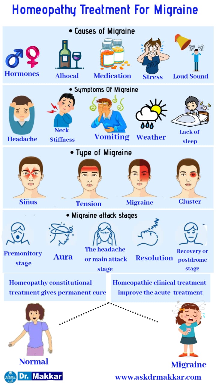 Homeopathic treatment for migraine