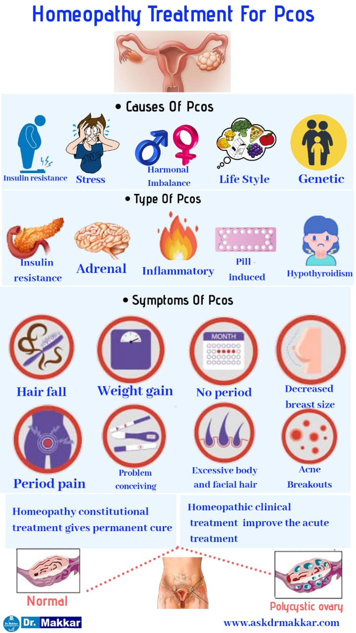 Homeopathic treatment for pcos