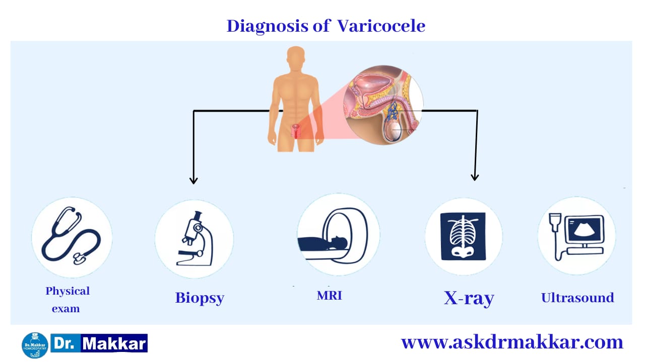 How is a varicocele diagnosed? ||  वैरिकोसेलेकी का निदान कैसे किया जाता है?