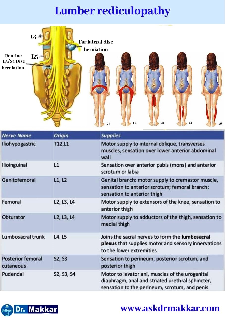 Lumber rediculopathy root nerve supply compression of nerve root effect on Part of body Supplied Lumber rediculopathy root nerve supply compression of nerve root effect on Part of body Supplied  || शरीर के अंग पर तंत्रिका जड़ प्रभाव के लंबर रेडिकुलोपैथी रूट साइटिका तंत्रिका आपूर्ति संपीड़न