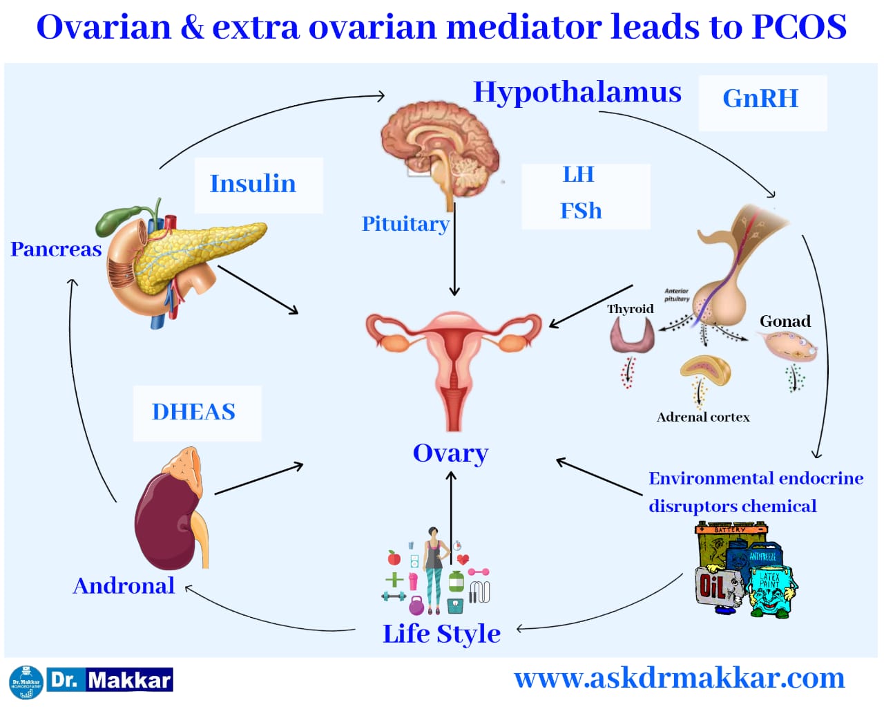 Ovarian & extraovarian factors leads to PCOS