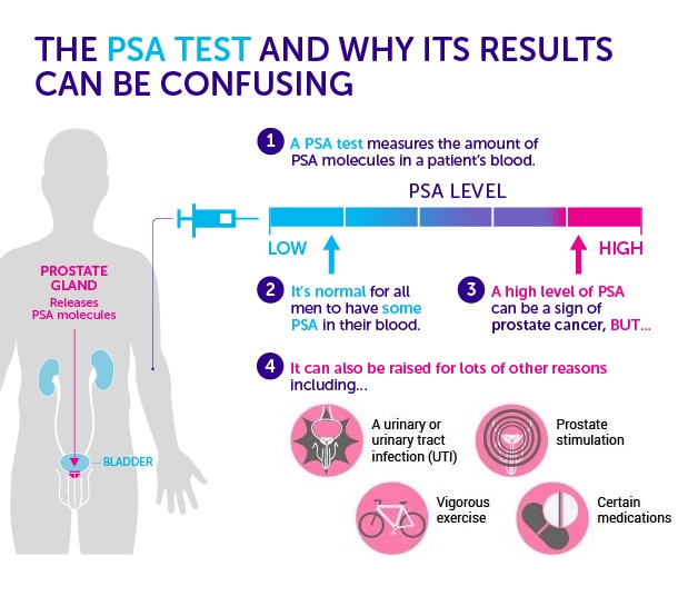 PSA-test-prostrate-specific-antigen.