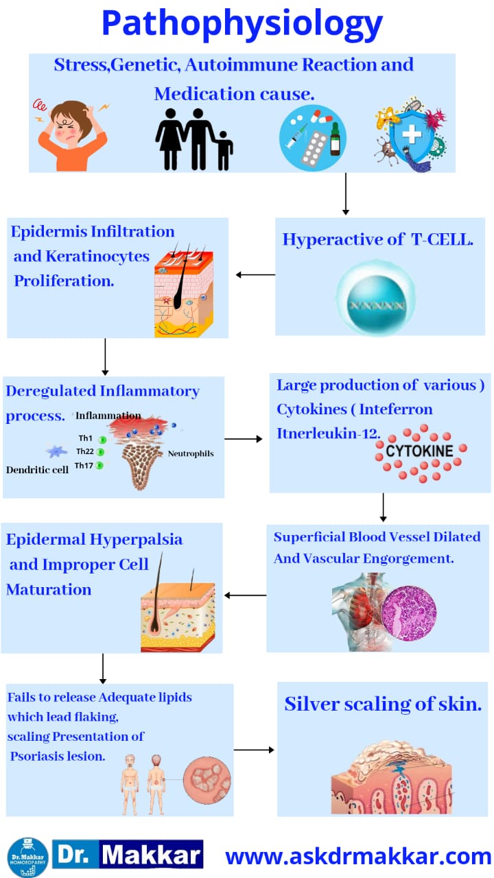 Pathophysiology of Psoriasis skin disease  || सोरायसिस की पैथोफिजियोलॉजी