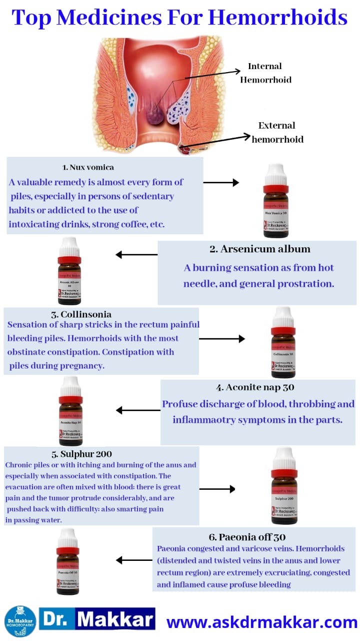 Best Homeopathic Medicines for Piles Hemorrhoids || पाइल्स बवासीर के लिए सर्वश्रेष्ठ होम्योपैथिक ट्रीटमेंट होम्योपैथिक दवाएं से