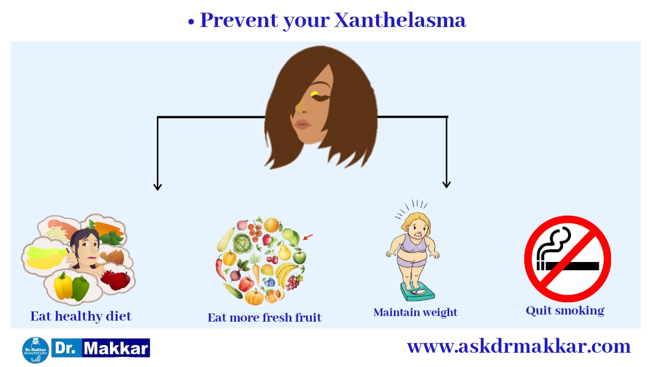Prevention of xanthelesma