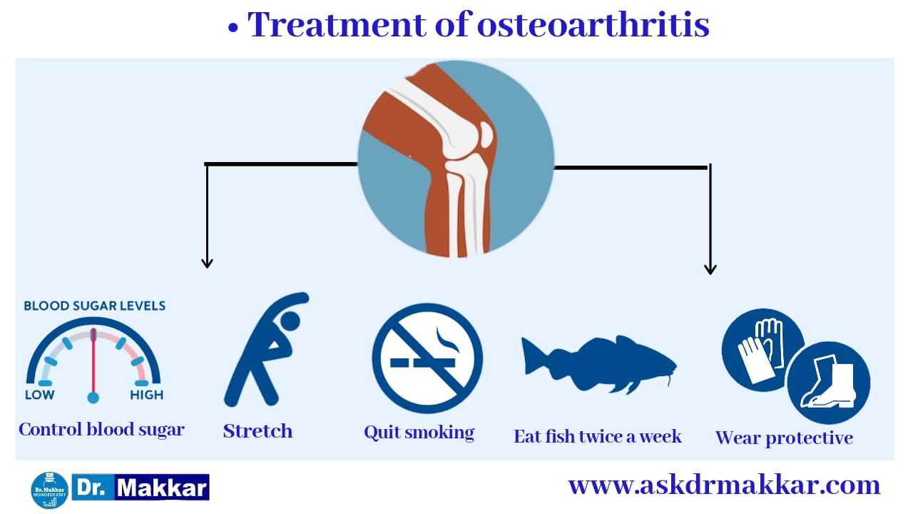 Prevention tios for Osteoarthritis