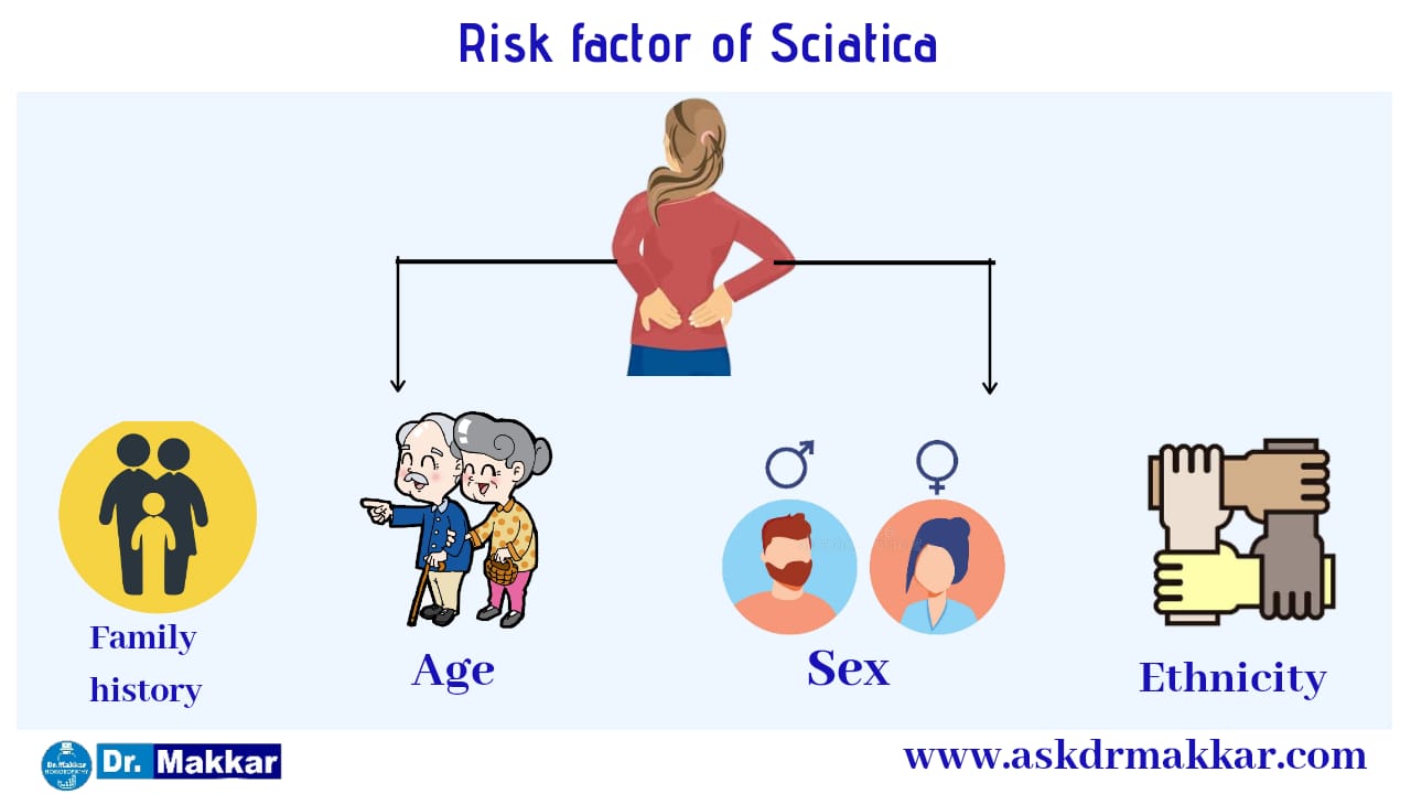 Risk factors for Sciatica Lumber rediculopathy root nerve supply compression 