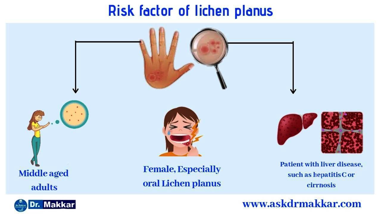 Risk factors for lichen planus || लाइकेन प्लेनस के जोखिम प्रकार कारण