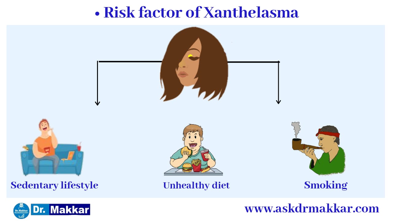 Risk factors of Xanthelesma