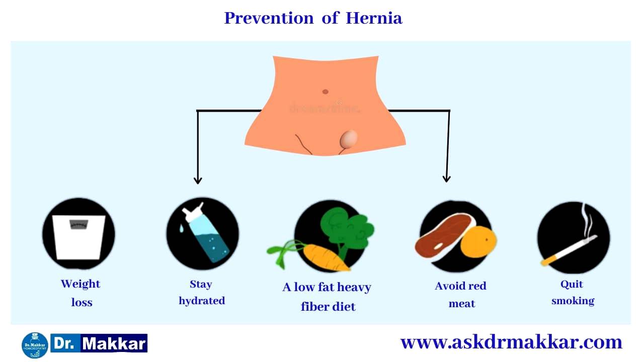 Self Care Home based Remedies Measure to tackle Hernia  हर्निया सेल्फ केयर होम आधारित उपचार हर्निया निपटने के उपाय