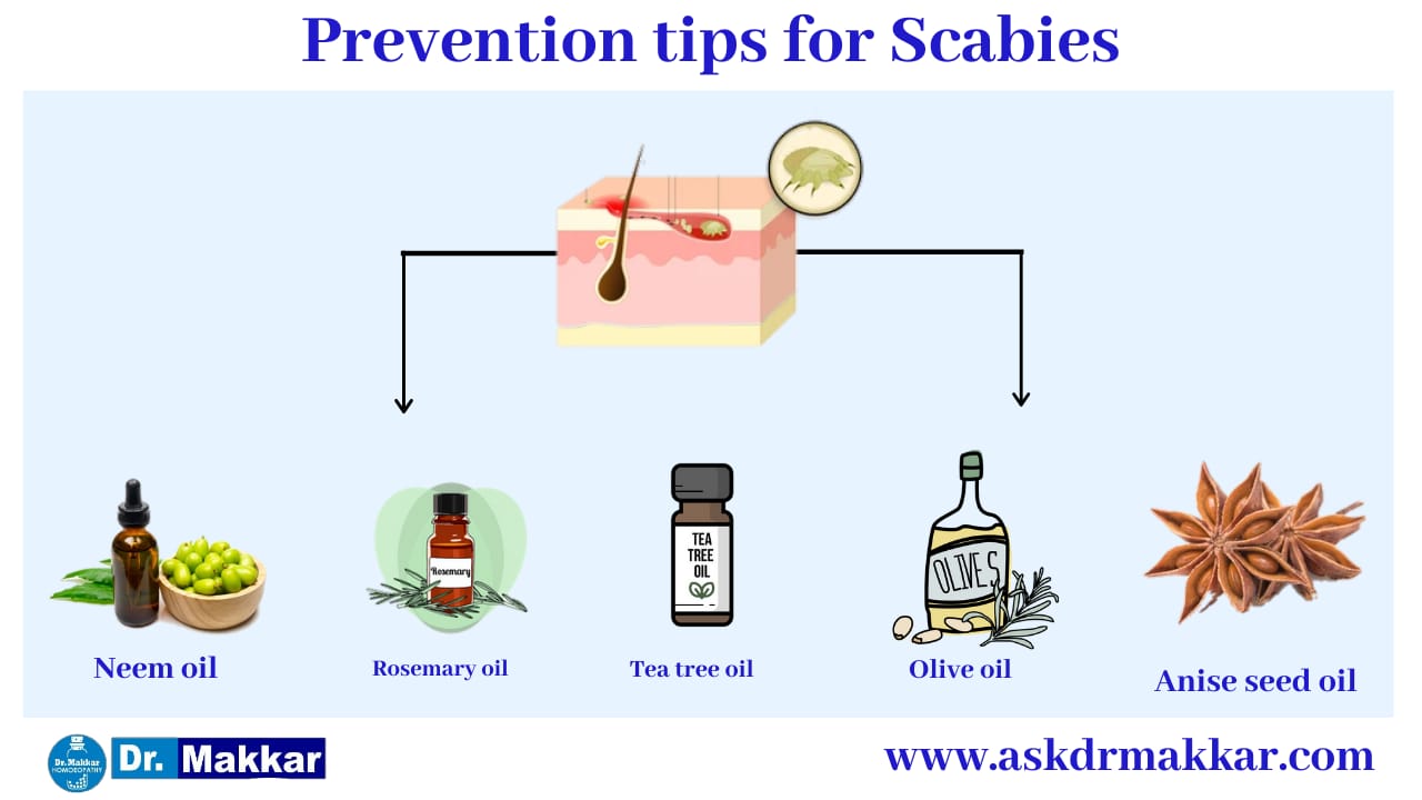 Self Care Home based Remedies Measure to tackle Scabies || स्केबीज या खाज  सेल्फ केयर होम आधारित उपचार स्केबीज या खाज  निपटने के उपाय