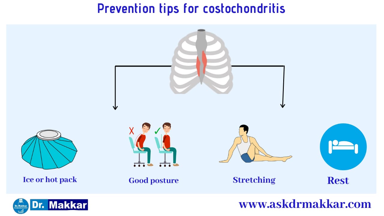 Self care Measure Costochondritis Pain in Ribs || कोस्टोकोंडाइटिस पसली में सूजन व्यायाम से छुटकारा 