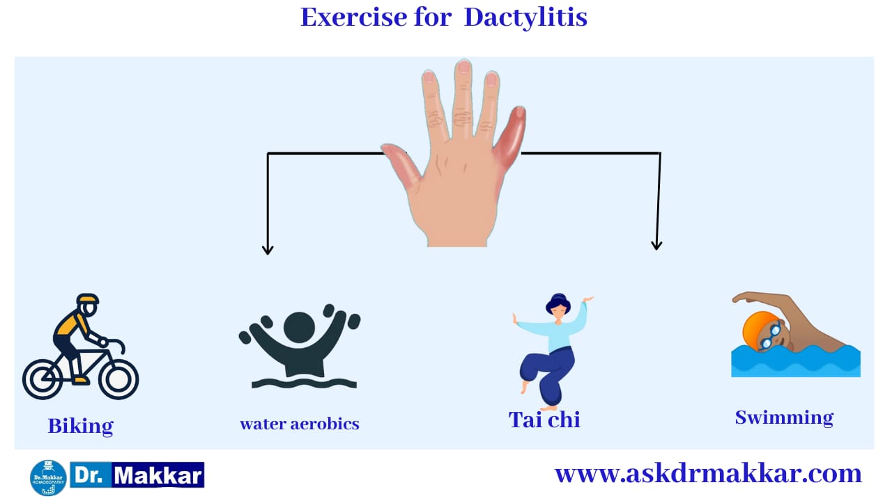 Self care Measure Dactylitis || Swelling in Digits Toes Fingers || डिप्रेशन से बचने के उपाय  || हाथ पैरों की सूजन से छुटकारा