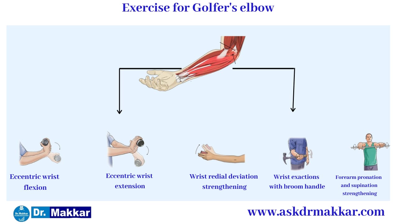 Self care Measure Golfers Elbow || गोल्फर एल्बो व्यायाम से छुटकारा 