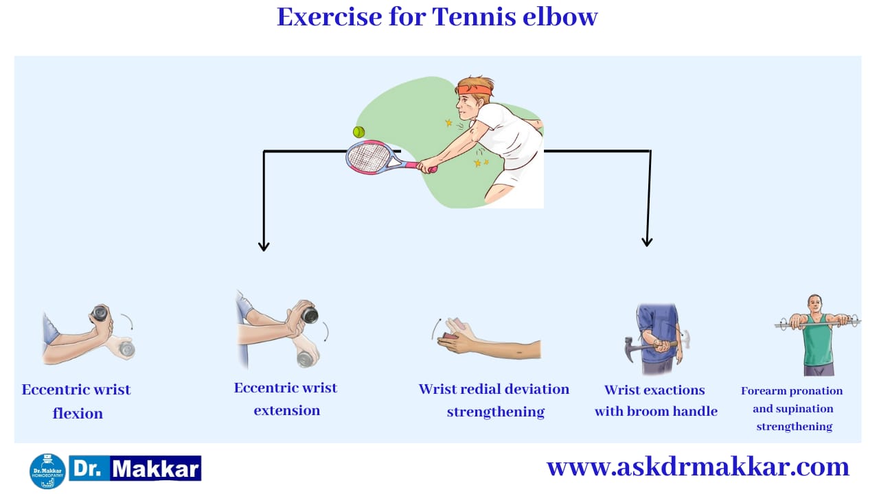 Self care Measure Tennis Elbow exercises || टेनिस एल्बो व्यायाम से छुटकारा