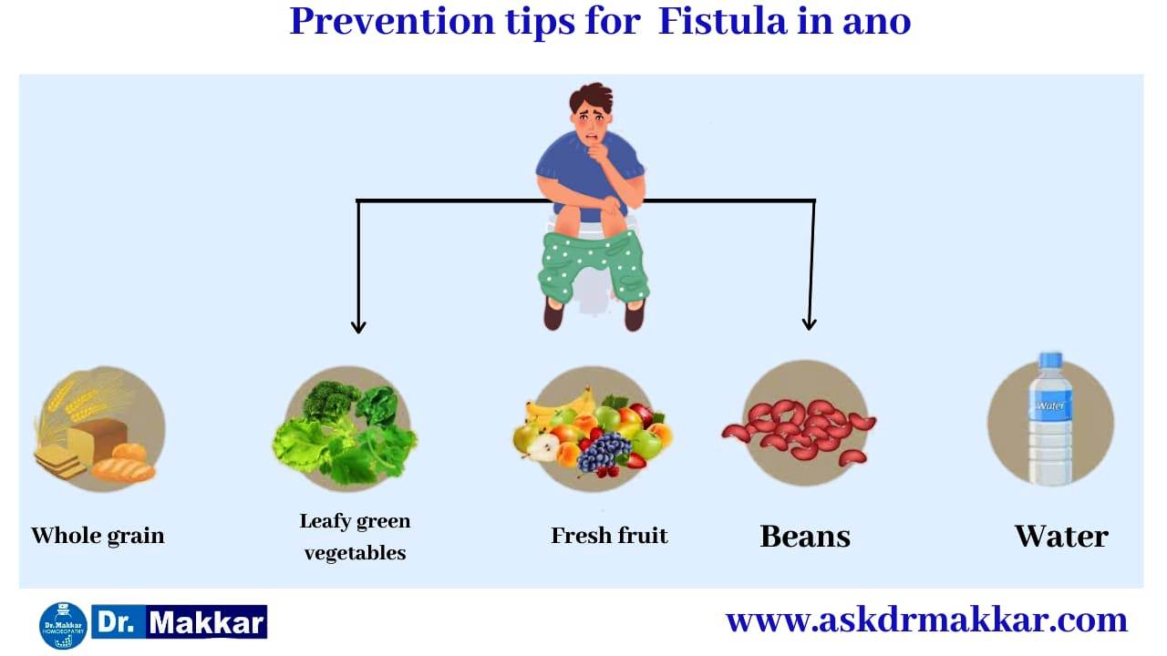 Self care measure in Fistula in ano also called fissure in ano  || भगन्दर एनल फिस्टुला में सेल्फ केयर माप को जड़ से खत्म करने के उपाय