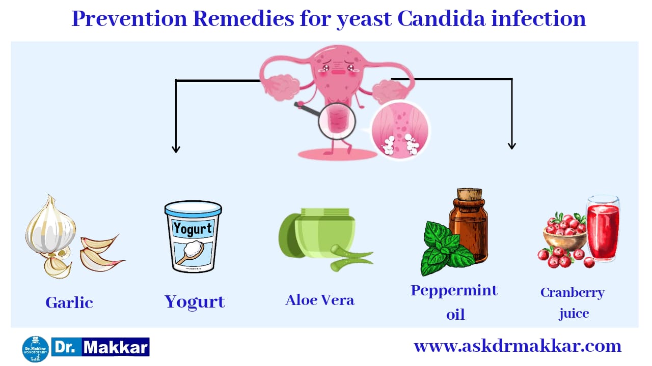 Self care measures to cure Vaginal yeast Candida infection  || यीस्ट वेजाइना योनि में खुजली जलन संक्रमण तरुण योनि शोथ को जड़ से खत्म करने के उपाय