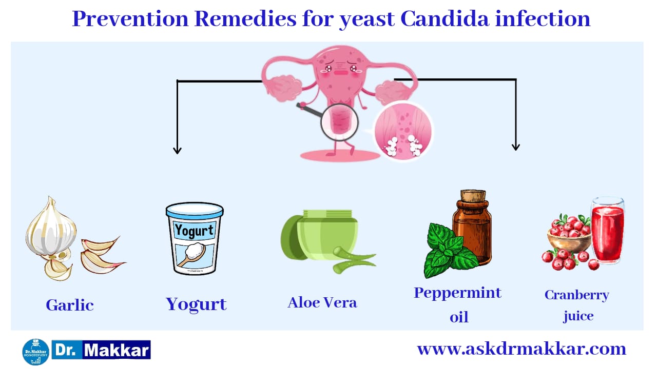 Self care measures to cure Vaginal yeast Candida infection  || यीस्ट वेजाइना योनि में खुजली जलन संक्रमण तरुण योनि शोथ को जड़ से खत्म करने के उपाय