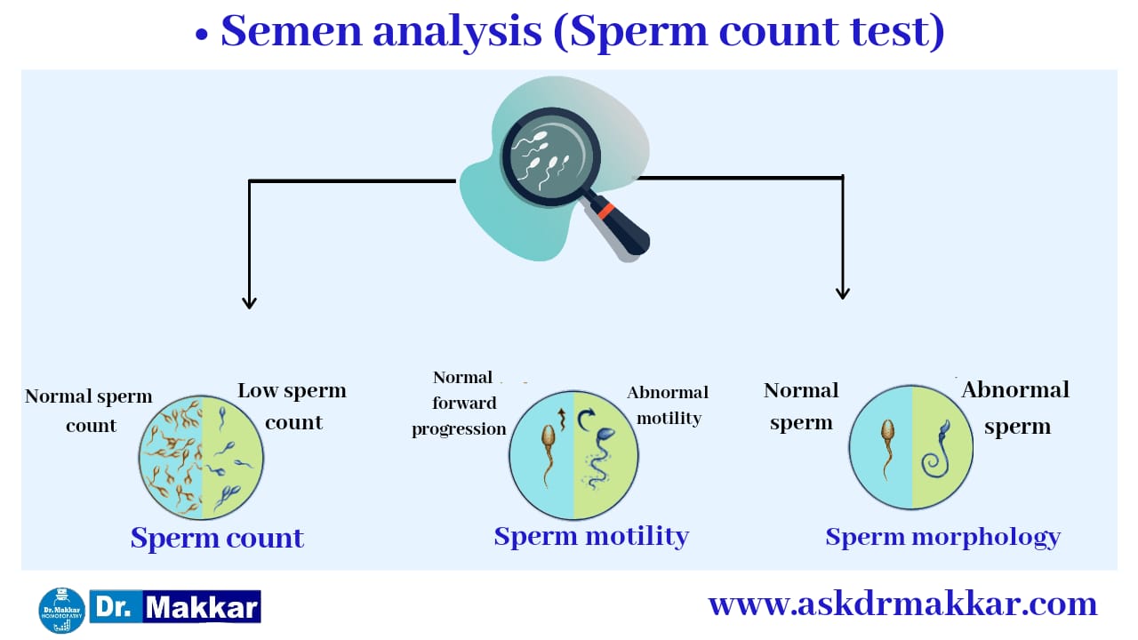 Semen count semen analysis निल स्पर्म काउंट ट्रीटमेंट एज़ोस्पर्मिया शुक्राणु का मूल्यांकन