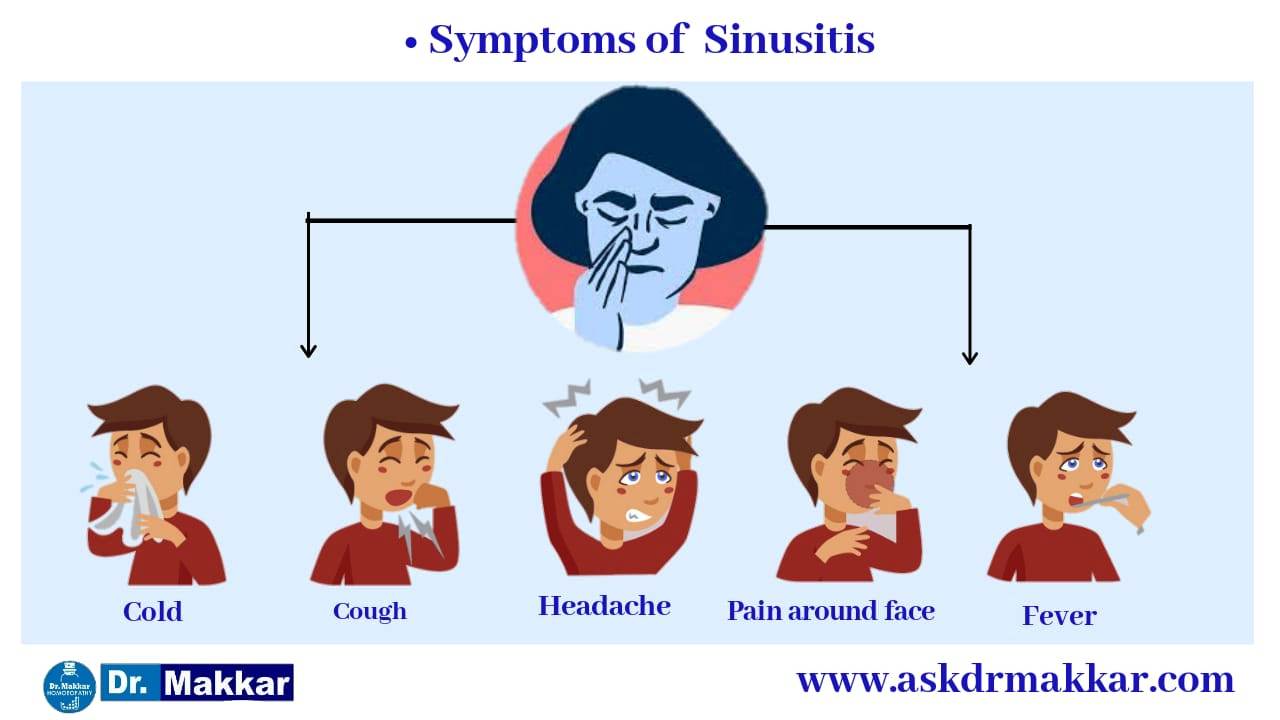 Sinusitis symptoms  Right diagnosis on basis of symptoms  approach helps to cure for Sinusitis