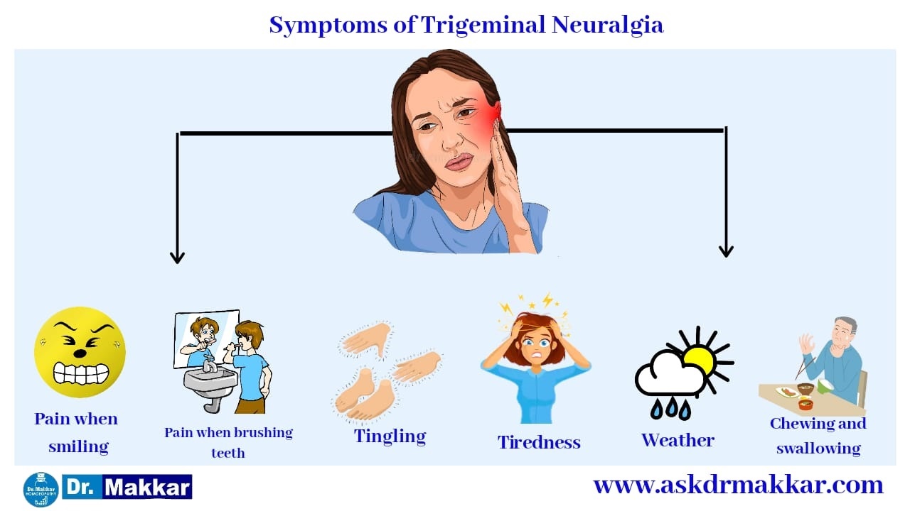 Symptoms Of Trigermial Neuralgia
