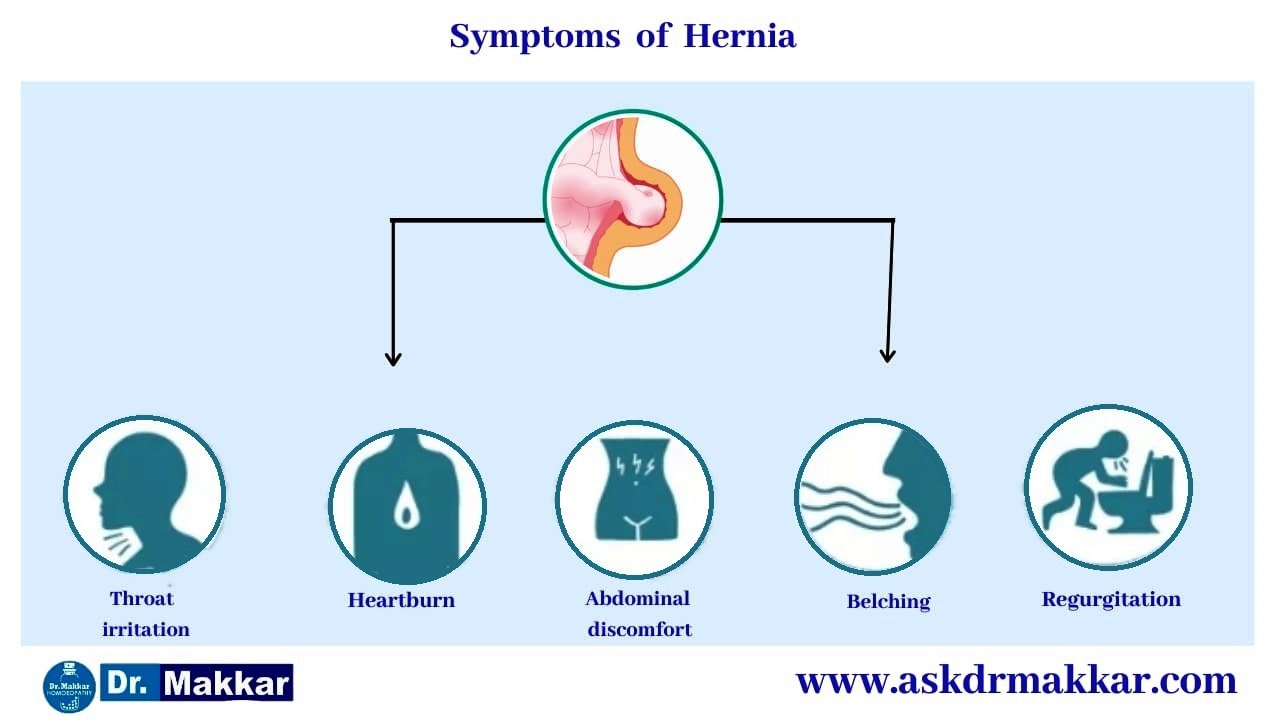 Symptoms for Hernia || हर्निया के लक्षण