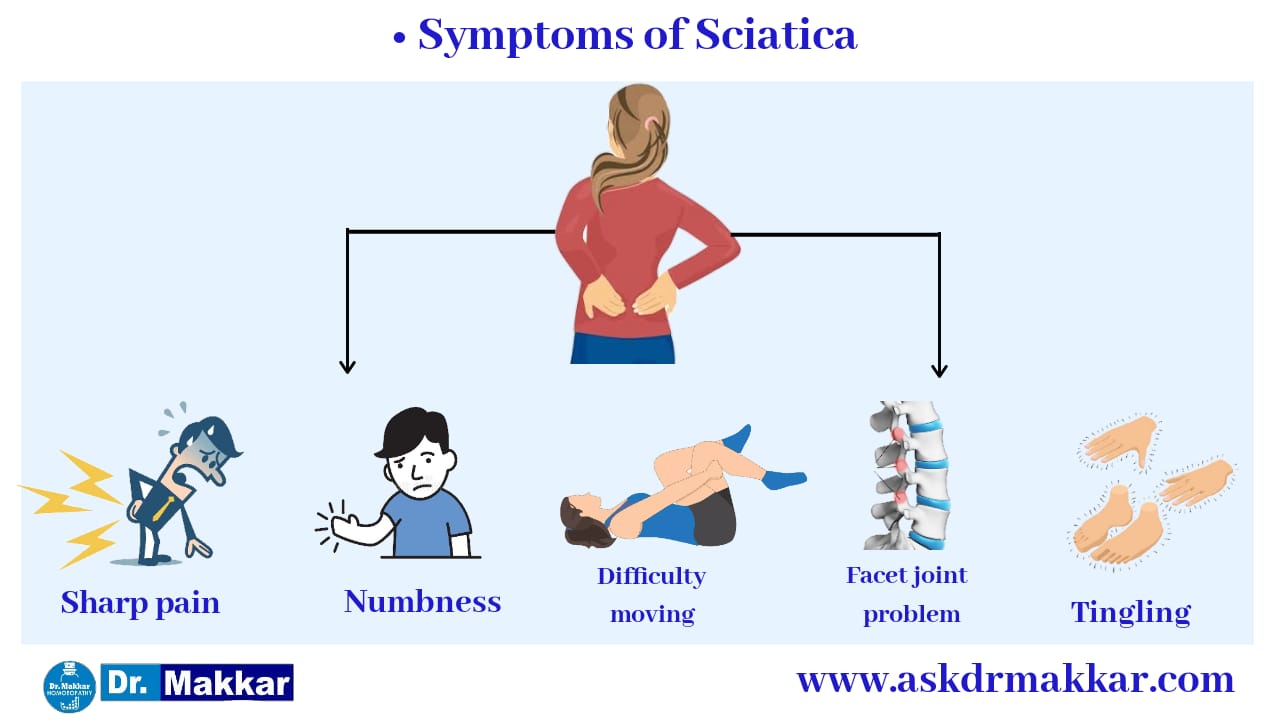 Syptms for Sciatica Lumber rediculopathy Sciatica Nerve comression