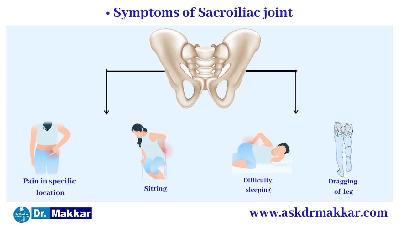 Symptoms of   Sacroiliac Joint Dysfunction SI Joint Pain || सैक्रोइलियक संयुक्त रोग जोड़ों का दर्द  के लक्षण