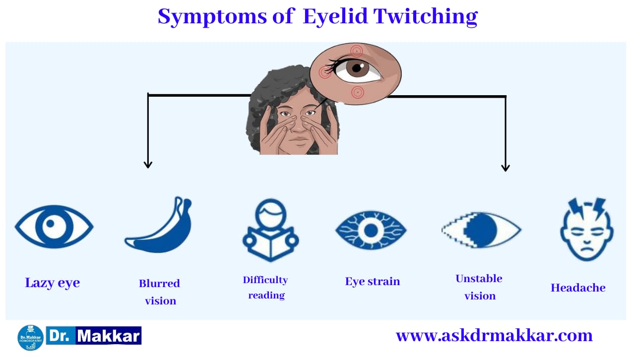 Symptoms of  Blepharospasm Twitching eyelid || ब्लेफरोस्पाज्म आंख फड़कने झपकना के लक्षण