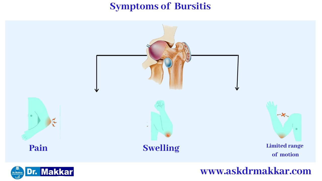 Symptoms of  Bursitis || बर्साइटिस के लक्षण