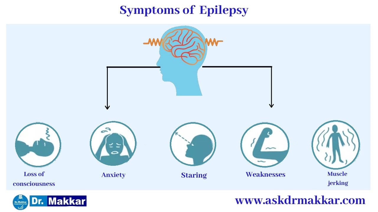 Symptoms of  Epilepsy seizure  मिर्गी का दौरा के लक्षण