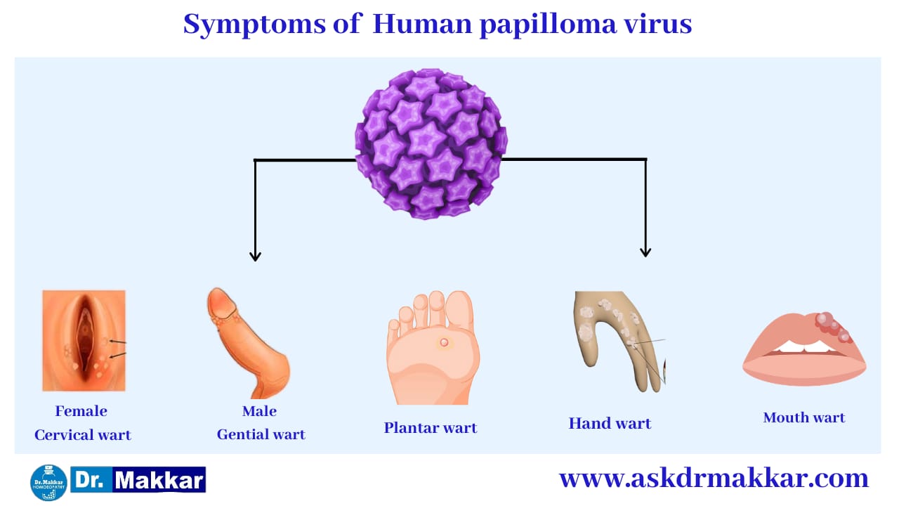 Symptoms of  Human Pappiloma Virus HPV || ह्यूमन पेपिलोमा वायरस एचपीवी  के लक्षण