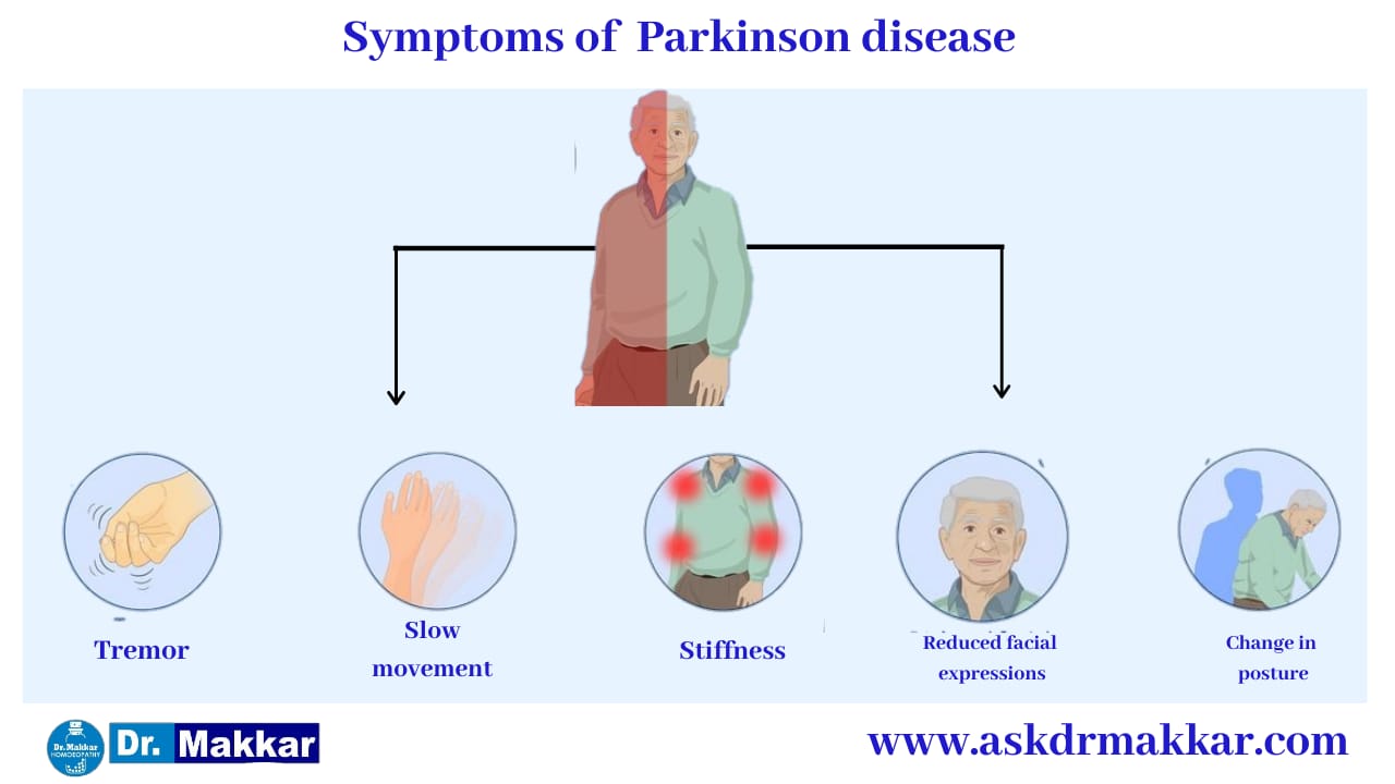 Symptoms of  Parkinson Disease || पार्किंसन डिजीज तंत्रिका तंत्र के लक्षण 